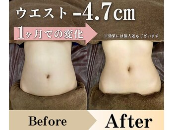 ニコ 千葉店(NICO)の写真/結果を急ぎたい方◎短期集中・本気痩身60分3回コース36,000円→18,800円!
落ちにくい脂肪・むくみケアに◎