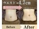 ニコ 千葉店(NICO)の写真/結果を急ぎたい方◎短期集中・本気痩身60分3回コース36,000円→18,800円!
落ちにくい脂肪・むくみケアに◎