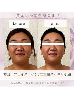 ピーチハート(Peach Heart)/新メニュー黄金比小顔全身コルギ