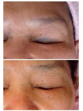 エピシア(EPICIA)/ハーブ1回でこの明るさ☆