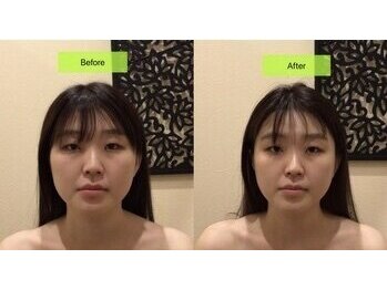 アジール 新潟市(agir)/Before/After画像