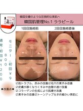 ミーカラー(mecalla.)/ララピールBA