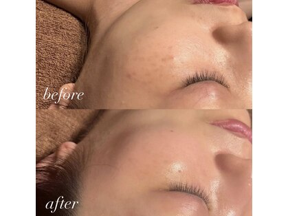 マハロヌイロア(mahalonuiloa)の写真