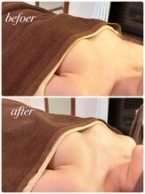 シャルマン(Charmant)/befoer、after