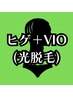 【新規】ヒゲ＋VIO脱毛(陰茎・睾丸込)◆◇メンズ脱毛