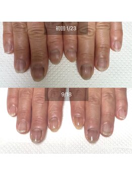 シープラス/ジェル育成