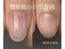 ロイヤル ネイルサロン(Royal nail Saloon)/自爪育成3か月