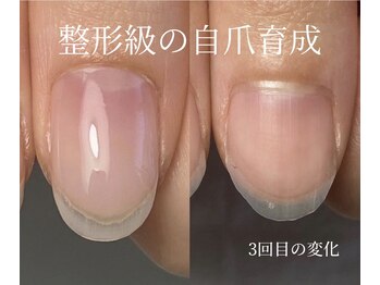 ロイヤル ネイルサロン(Royal nail Saloon)/自爪育成3か月