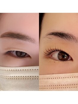 アイビューティー(AI beauty)/二重整体【ダブルアイリフト】