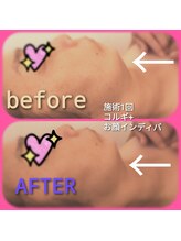 ほしにはろー/スッキリ