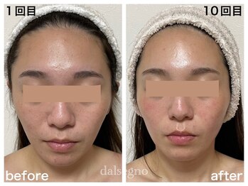 ダルセーニョ/頭を超小さく！お顔も超小顔に！