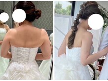 ヴィクシア(VIXIA)/ブライダル痩身