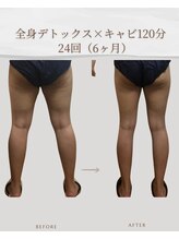 アメリオ(Amelio)/全身デトックス+キャビ120分