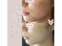 リラクゼーションサロン ラキ(laki)/トロイアルケ