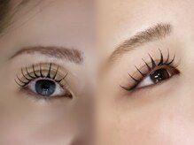 Q3. 「エクパーマ」って何？