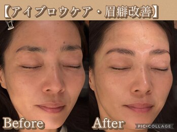 ボディリカバリー(Bodyリカバリー)/