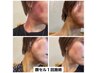 【500円OFF】☆男女☆スライドカッピング顔20分 ￥9,900→￥9400
