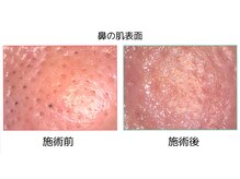 ベベ 目黒店(Be'be')の雰囲気（シミ、シワこれからの紫外線対策などのお悩みを見ていきます！）