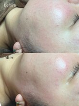 クロシェ/もみあげをナチュラルにデザイン