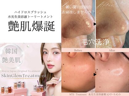 ミモア(mimoi.)の写真