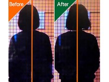 アセルカイロプラクティック/姿勢分析　阿佐ヶ谷/整体/カイロ