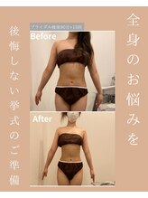 メゾンワン(maison one)/挙式前ボディ改革