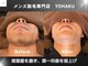 ヨハク(YOHAKU)の写真