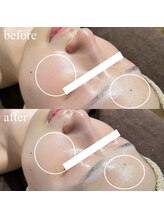 ブレデサガ(B’lady Saga)/綺麗なお肌もより綺麗なお肌へ☆