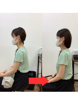 ぷらもーる梅屋敷整骨院/beforeafter#蒲田#肩こり#整体