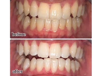 トミー(TOMMY)/【ビフォーアフター】