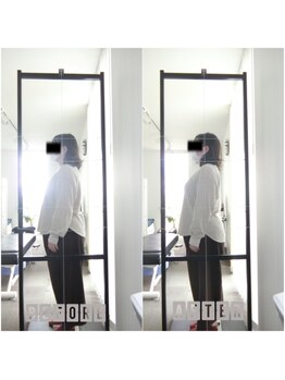イトウ カイロプラクティックパートナー(ITOU)/Before&After