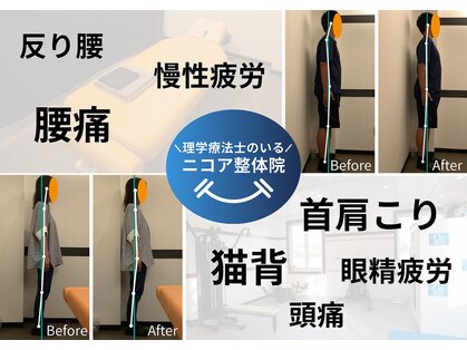 にこあ(nicore)の写真