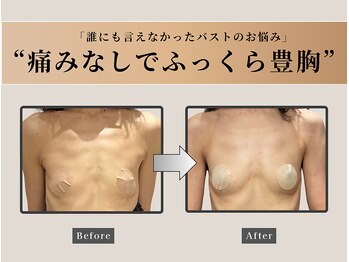 オーク ナチュリ 成城学園前(OAK×NACHUL)/傷みのないふっくら豊胸