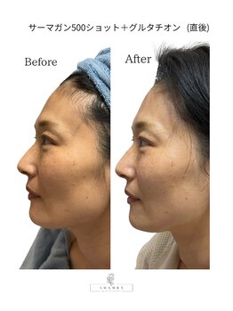 シャムリー(SHAMRY)/サーマガン500ショット