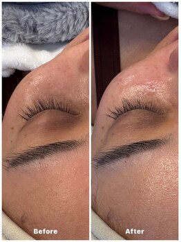 クラルテアンドコー(Salon Clarte&Co.)/韓国/乳酸ダクトピール♯1回