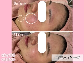 エン クリニカルラボ 心斎橋店(E&N CLINICAL LABO)/白玉パッケージ☆