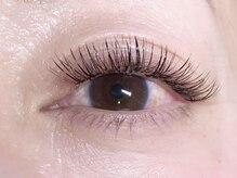 フェディス(Fedis)