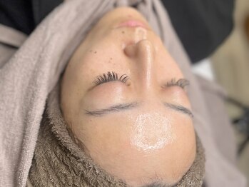 ポレ(pole)の写真/ピーリングで憧れのノーフォンデ肌へ*。話題の''レモンボトル''もフェイス、ボディに施術◎