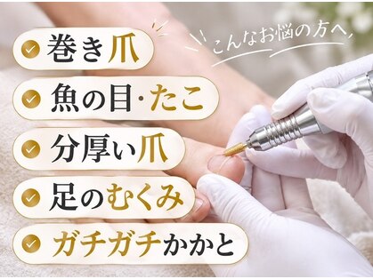 コトリ(Kotori)の写真