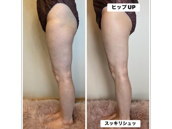 ローズ 下松(ROSE)/【姿勢もスッキリ整えます♪】