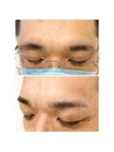 アイビー 神保町店(i.b)/眉【before⇒after】３１