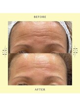 スタイルドアー(style door)/ExoLift 