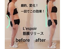 レスポワール(L'espoir)の雰囲気（姿勢.改善したい方に、オススメ！筋膜リリースの絶大なる効果！）