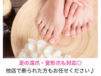 トイロ(toiro)/足の深爪も変化します