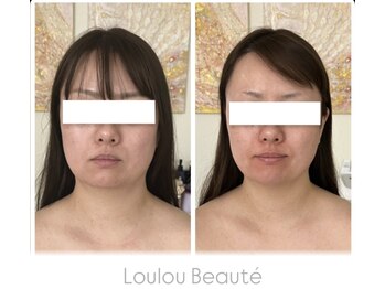 ルルボーテ(Loulou Beaute)/レモンボトル