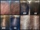 トータルビューティー ソラン(Soran)の写真