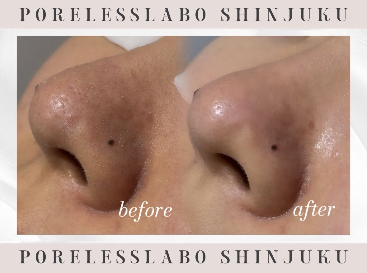 拡大鏡エステ　アイサロン　毛穴サロン　廃盤品 拡大鏡エステ アイサロン 毛穴サロン 廃盤品 拡大鏡・ルーペの通販・卸