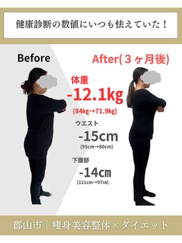 整体院 モンテ(monte)/before＆after