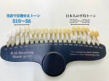 ピュアホワイトニング 横浜店/ホワイトニング目指せるカラー