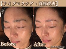 ボディリカバリー(Bodyリカバリー)/